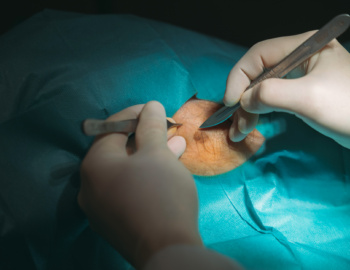 Chirurgie de la main en salle d'opération